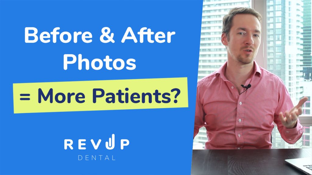 Are the before and after photos on your dental website actually attracting more patients? Is this really what patients look for when deciding on a dentist? Well we’ve run some A/B testing experiments and determined that these photos may be doing more to scare away your potential patients rather than attracting them.